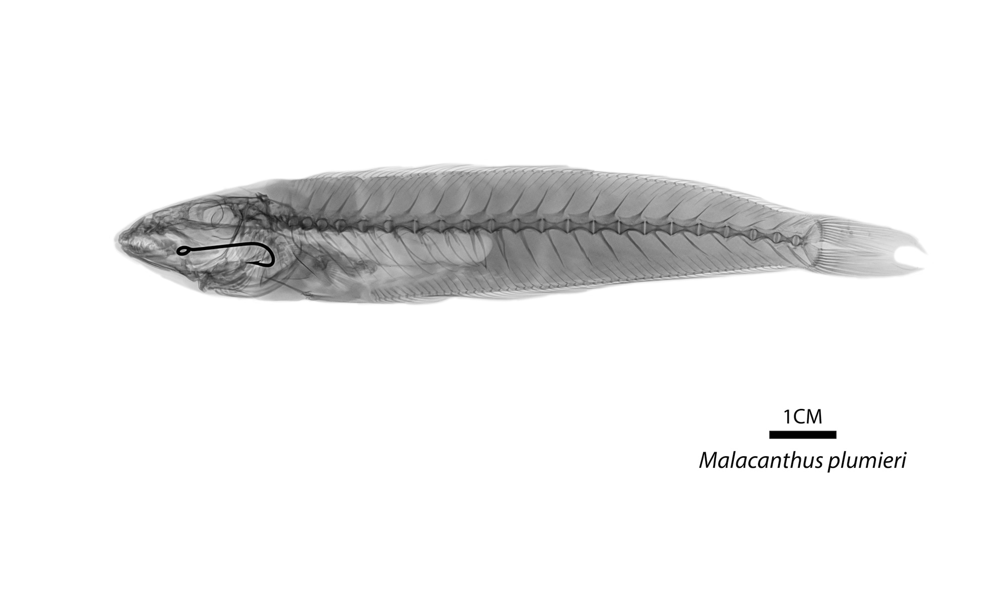 Radiografía especie